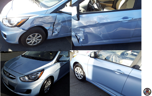 Hyundai-Before-&-After